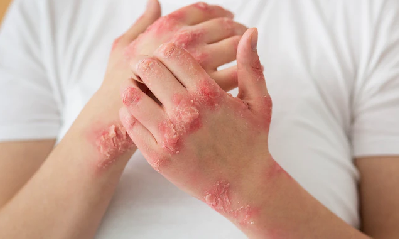 itchy skin rash telehealth
