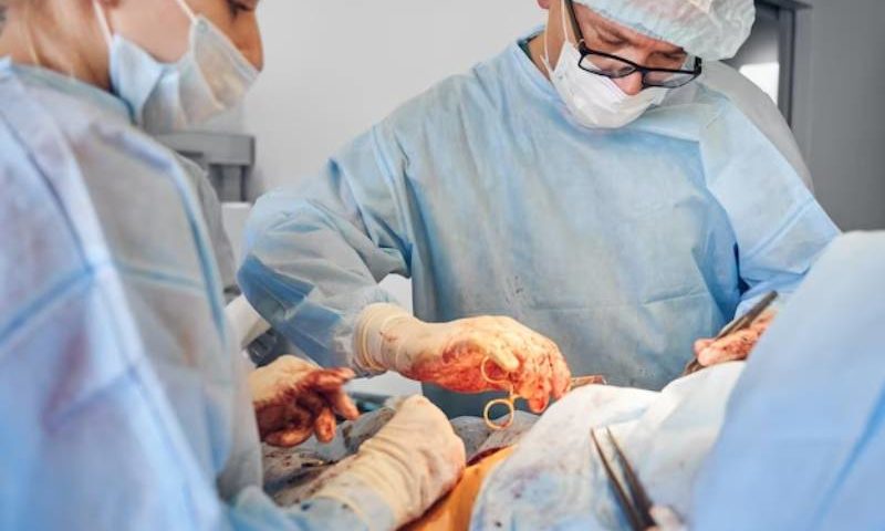 gall stone surgery