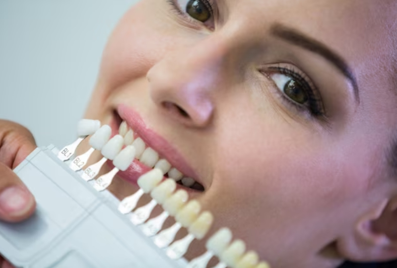 veneers in tucson
