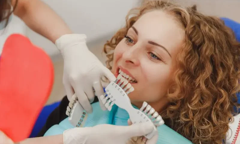 veneers