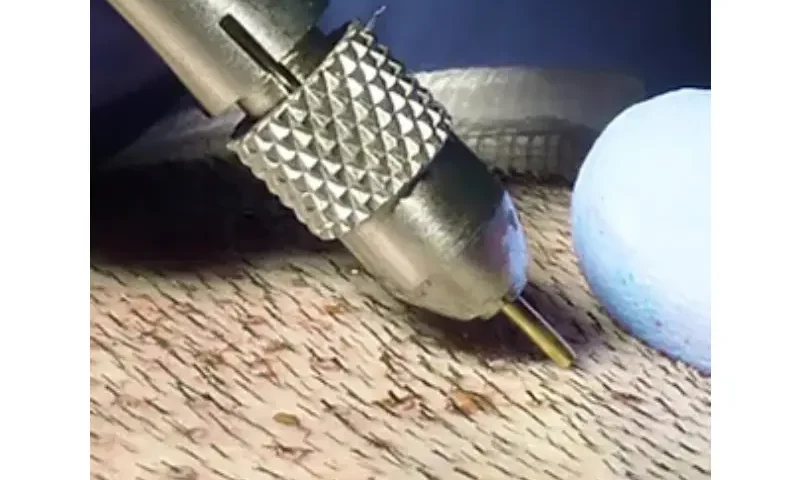 Hair Transplant in Turkey